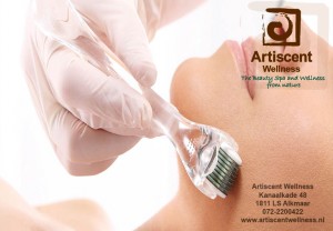 mesotherapy-alkmaar-bij-artiscent-wellness-kanaalkade